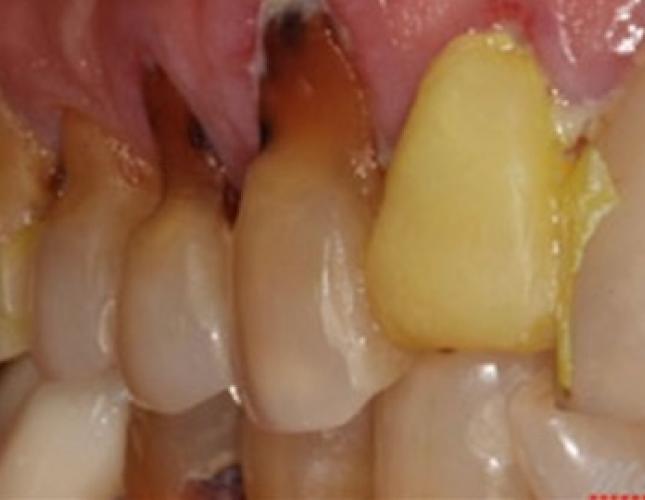Case 20 before
