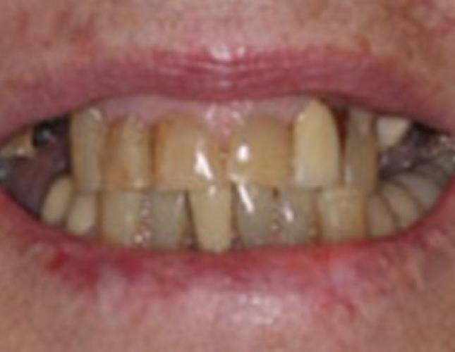 Case 21 before