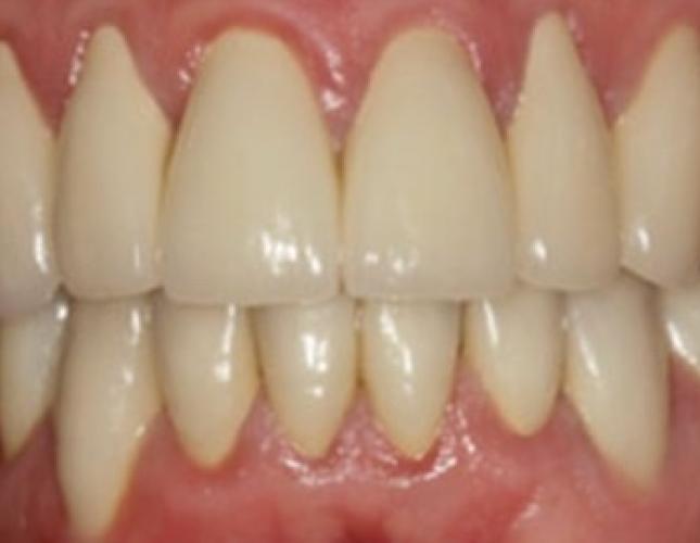 Case 23 after Case 23 after