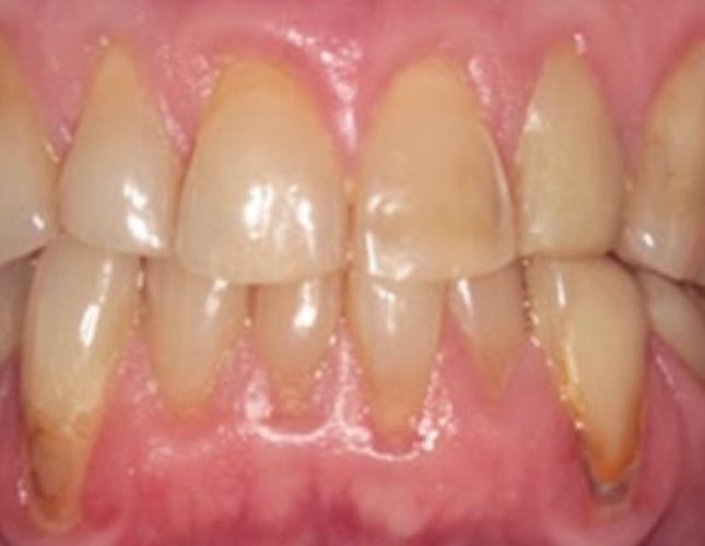 Case 23 before Case 23 before