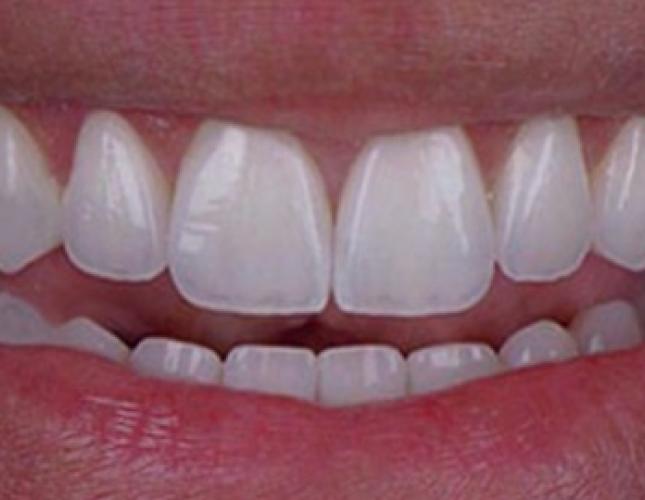 Case 2 After Case 2 After