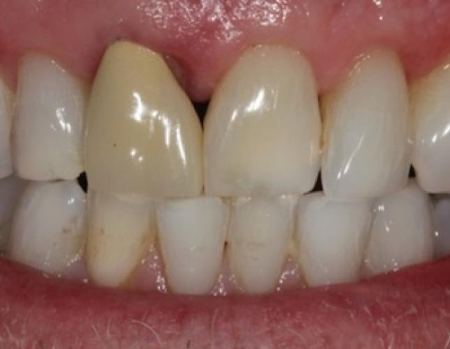 Case 6 before Case 6 before