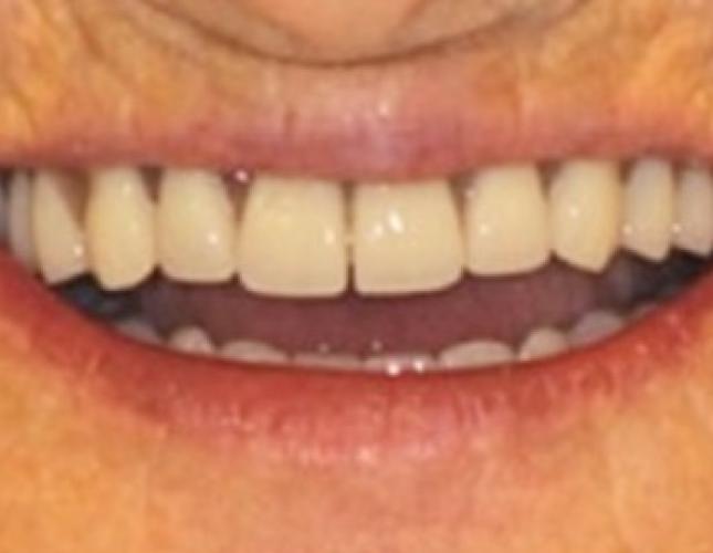 Case 7 after Case 7 after