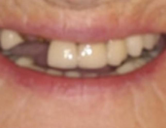 Case 7 before Case 7 before