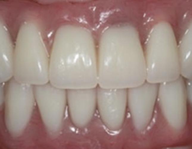 Case 8 after Case 8 after
