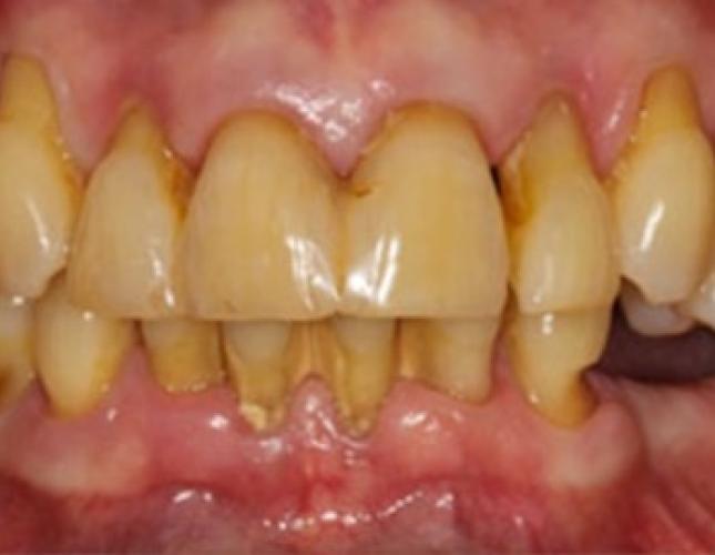 Case 8 before Case 8 before