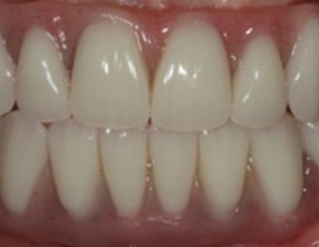 Case 9 after
