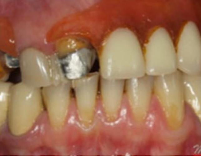 Case 9 before