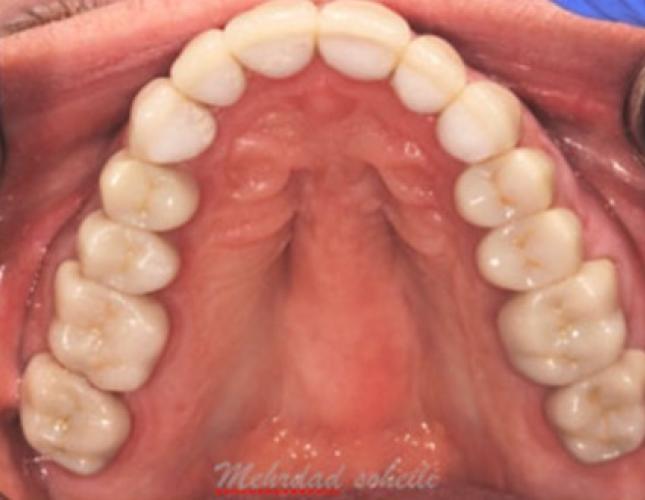 Case 12 after