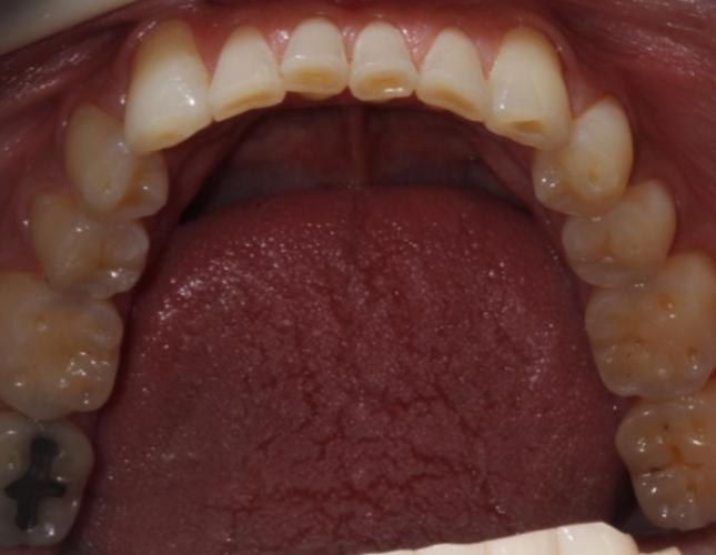 case 14 before case 14 before