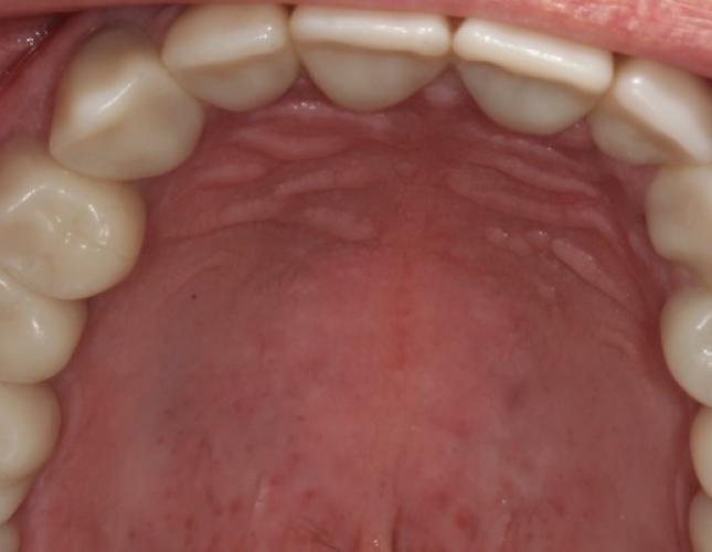 Case 21 after