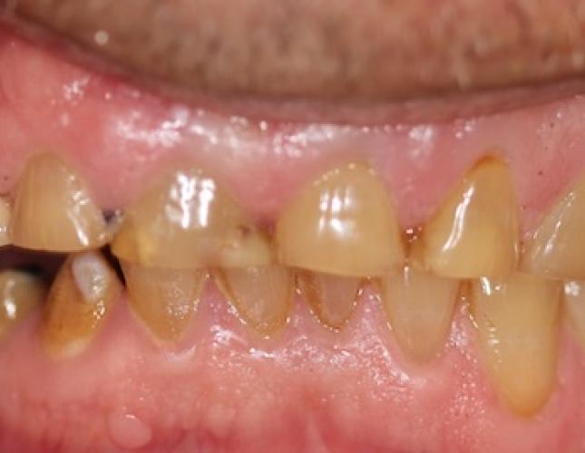Case 21 before Case 21 before