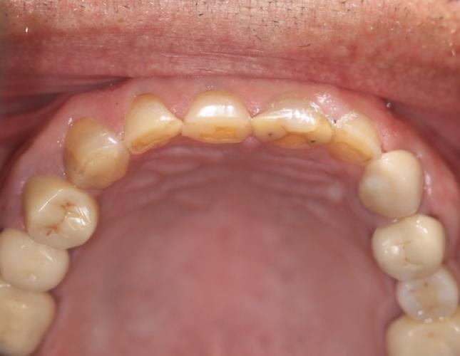 Case 21 before