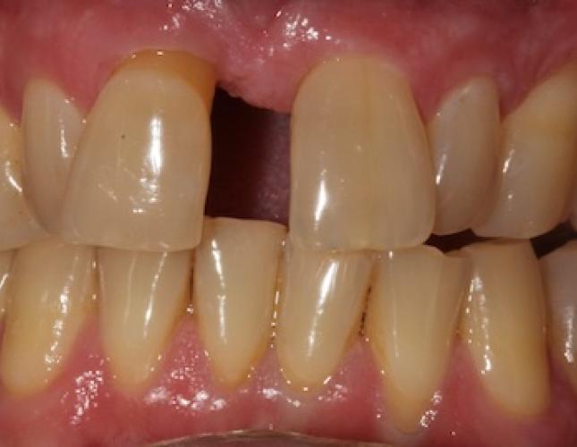 Case 22 before Case 22 before