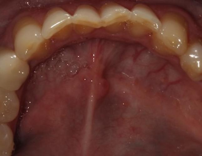 Case 22 before