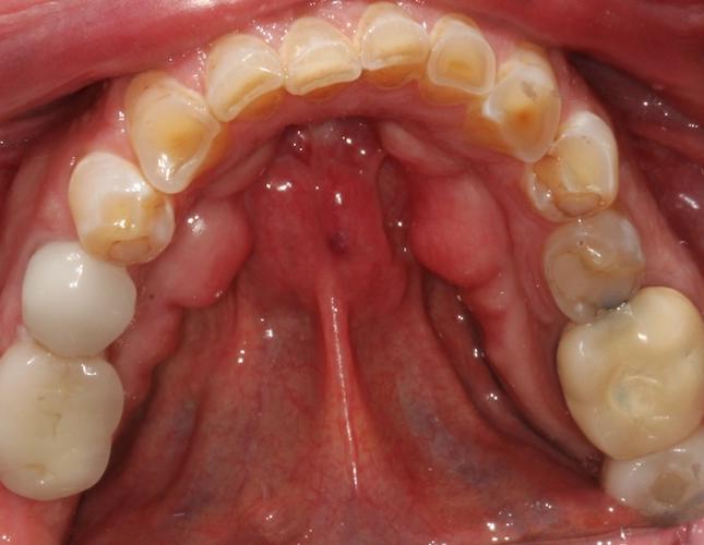 Case 23 before