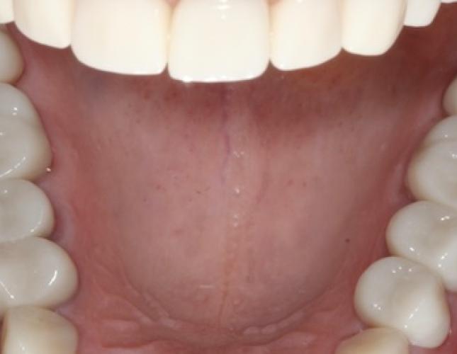 Case 24 after