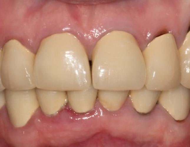 Case 24 before Case 24 before