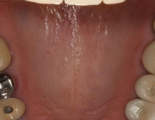 Case 24 before